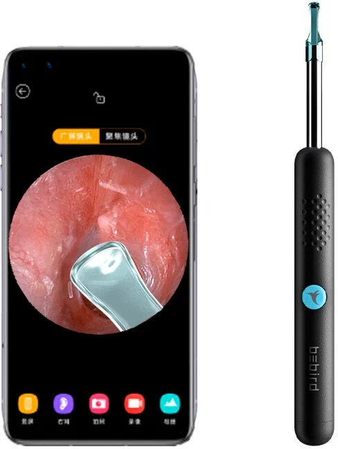 Аксессуары Xiaomi - Умная лопатка для чистки ушей Xiaomi BeBird Smart Visual Spoon Ear Stick R1