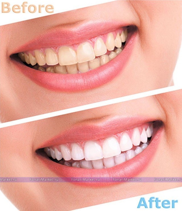 Женские товары - Набор для отбеливания зубов Luma Smile Whiten & Polish