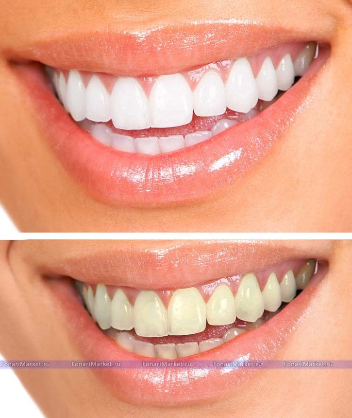 Товары для одностраничников - Отбеливающие полоски для зубов 3D White Teeth Whitening