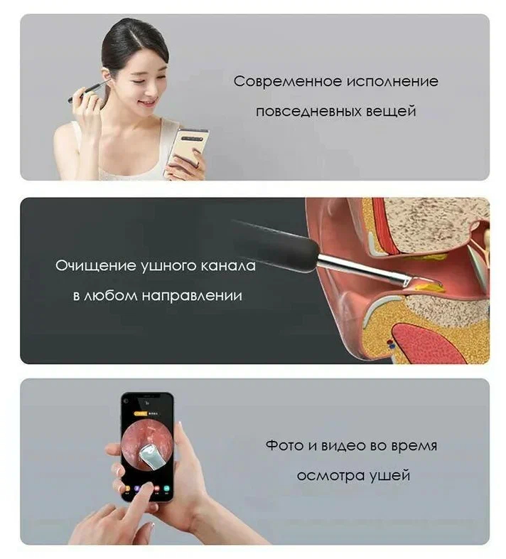 Аксессуары Xiaomi - Умная лопатка для чистки ушей Xiaomi BeBird Smart Visual Spoon Ear Stick R1